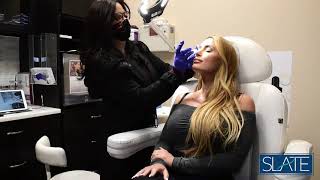 Botox treatment | Slate Medspa | Dana
