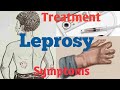 What is Leprosy? | What causes Leprosy| Leprosy Diagnosis