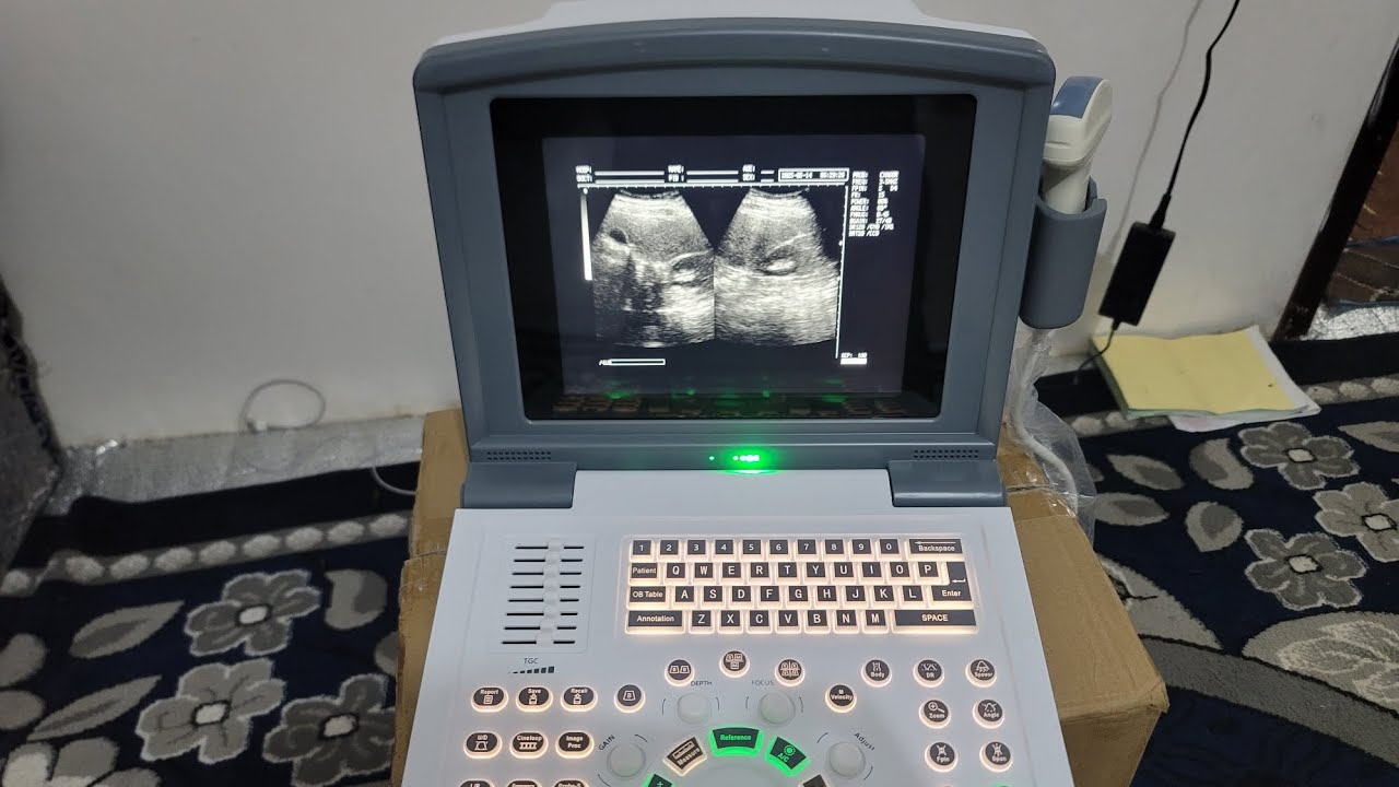 شرح كامل لجهاز سونار Full digital وطريقة العمل علية واخذ القياسات وضبط الوضوح