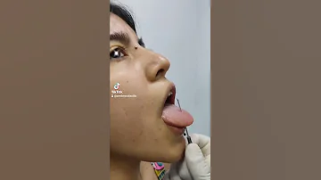 ¿Cómo se llama el piercing central de la lengua?