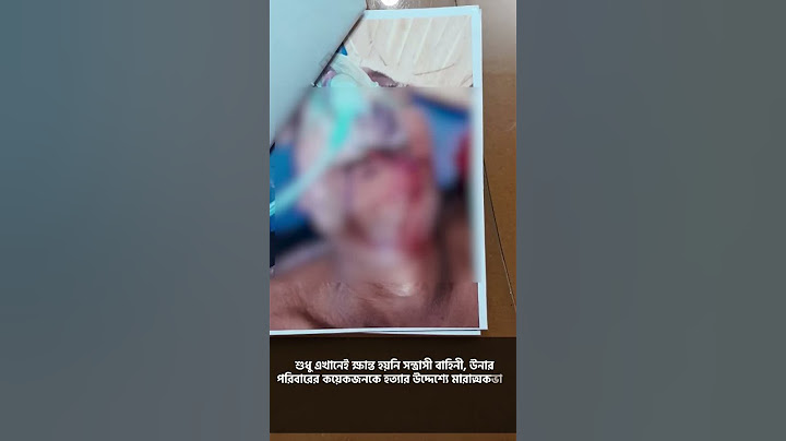 #কুষ্টিয়ায় এক #আওয়ামী লীগ নেতার কি অবস্থা করেছে দেখুননিজের চোখকে বিশ্বাস করতে পারবেন না#fypシ゚
