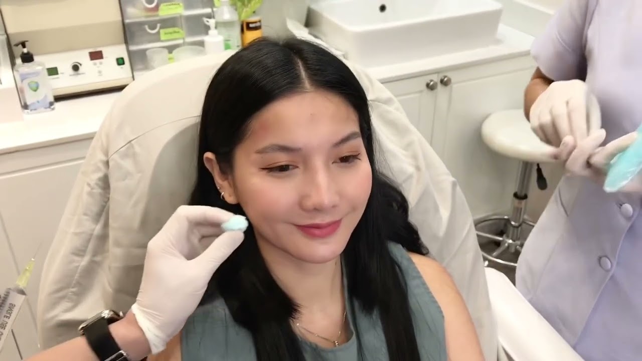 โบท็อกซ์ลดริ้วรอย หน้าผาก หางตา หว่างคิ้ว แค่หลักพันก็สวยได้