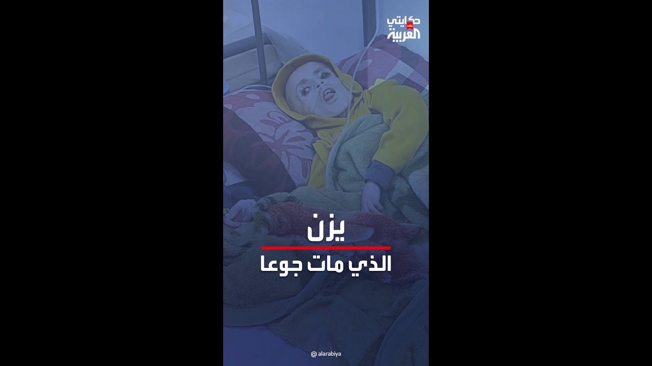 قصة مأساوية.. الجوع يقتل الطفل يزن الكفارنة في غزة بعد يوم من مقابلة مع العربية