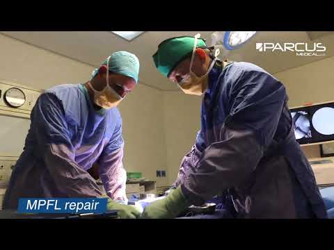 Dr. Mike Barrow discusses his approach to MPFL repair