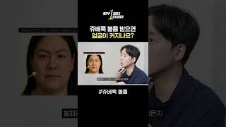 #쥬베룩 받고 얼굴이 커질 수 있나요? #쥬베룩볼륨 #리프팅