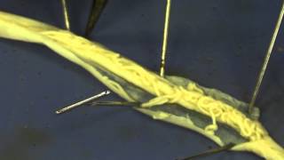 Roundworm dissection