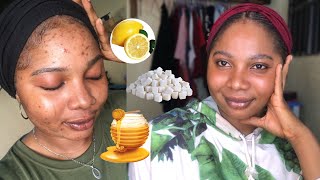 Hey loves ,here z a video on how i made the sugar scrub that used to
clear my acne scars and dark spot after got rid of !...if u like this
...