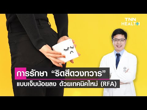 LIVE การรักษา“ริดสีดวงทวาร”แบบเจ็บน้อยลง ด้วยเทคนิคใหม่ (RFA) : Daily Health