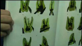 Root Tip 57