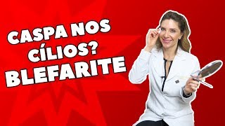Blepharitis - How to Treat Blepharitis