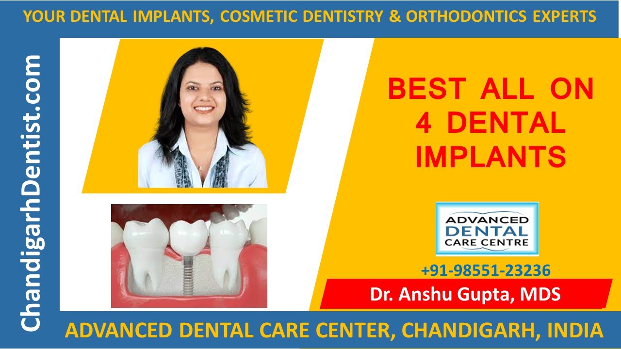Allon4 dental implants Chandigarh cost if all on 4 implant