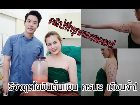 วีดีโอ: แขนควบคุมบนราคาเท่าไหร่?