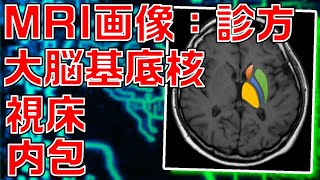 【脳画像：MRI】大脳基底核・視床・内包をMRI画像にて同定する方法を解説します！