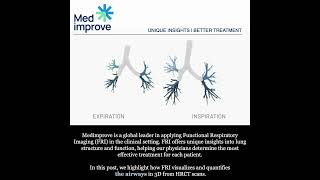 Airway as determined by Functional Respiratory Imaging (FRI)