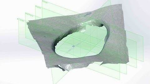 eKare inSight 3D Wound Imaging & Measurement for Clinical Research