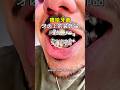 The $50,000 Smile: Everything You Need to Know About Grillz  #HipHopCulture #CustomGrillz
