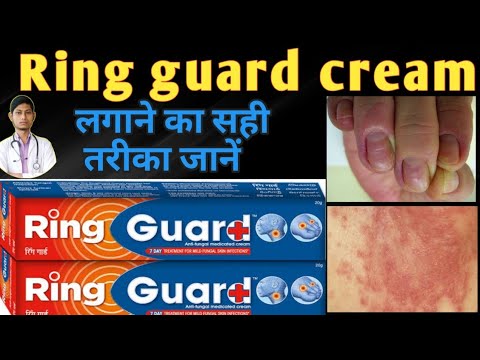 Ring guard cream review | Ring guard cream uses in hindi | ring guard cream  ke fayde - YouTube