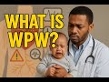 WPW Syndrome Explained 2025 WPW Syndrome Explained 2025
