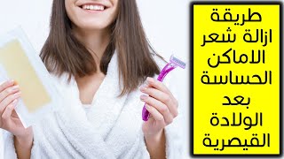 كيف ازيل شعر الاماكن الحساسة بعد العملية القيصرية بطريقة سهلة ( سؤال 190 )