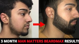 3 month beard growth minoxidil journey | minoxidil review beard growth | man matters beard oil |