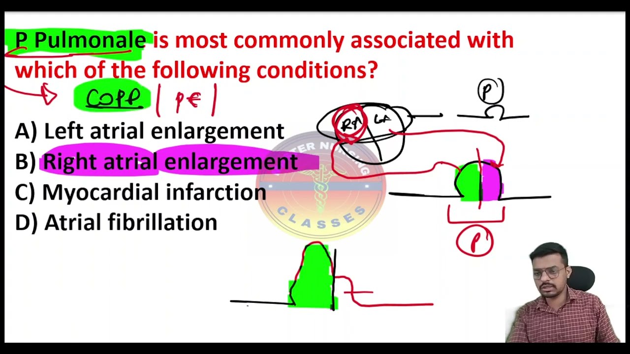 ECG //IMPORTANT CLASSES #aiimsnorcetexam #rrbnursingofficer #choexam #kea #nursingofficer