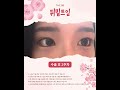 #더비비성형외과 답답한 눈매를 시원하게 개선