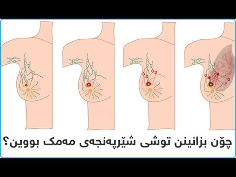 چۆن بزانینن توشی شێرپه‌نجه‌ی مه‌مك بووین؟