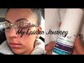 My Epiduo Journey (Weeks 1+2)