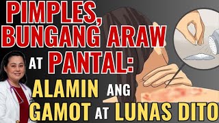 Pimples, Bungang Araw At Pantal Alamin Ang Gamot At Lunas Dito. - By Doc Liza Ramoso-Ong