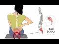 Tailbone Pain?| Coccydynia Kia hai| kyu hota hai| Kesy Thik Kryn?| Complete Guidance