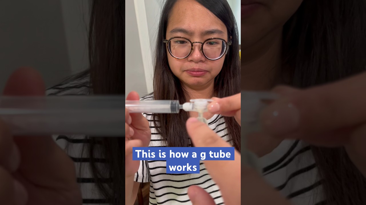 How to replace a g tube 