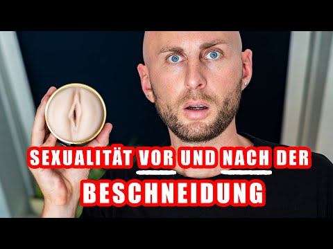 Beschneidung Sexualität! Beschnitten vs Vorhaut? Zirkumzision mit 33 Jahren. Erfahrungsbericht