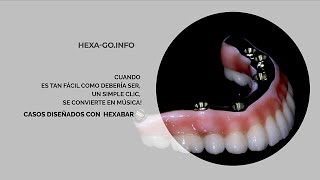 Casos diseñados con Hexabar. ¡Bienvenidos a un nuevo nivel de ajuste y calidad! 🎯