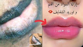 Remove dark spots from around the mouth and turn lips pink from the first use👄 screenshot 4