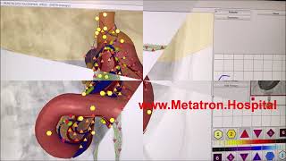 3D NLS health analyzer Metatron Hospital light waves human brain quantum resonance specific body