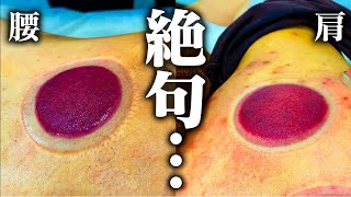 【吸い玉 院長】2ヶ月ぶりに院長に吸い玉したらとんでもない色が出た...