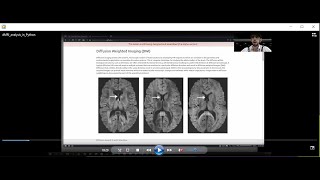 dMRI analysis in Python