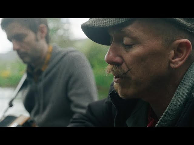 Foy Vance - Hair of the Dog