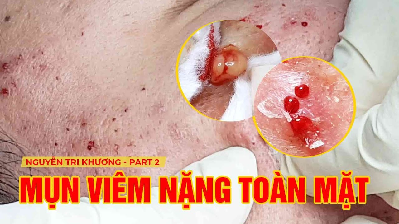 HHV Clinic | Đỗ Thu Hiền | Nguyen Tri Phuong - Part 2