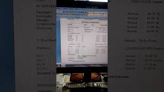 cbc print short video