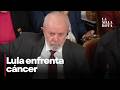 Lula da Silva enfrenta cáncer de piel y recibe radioterapia
