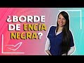 Encías negras al rededor de coronas y carillas dentales l Bordes de encías con lineas negras