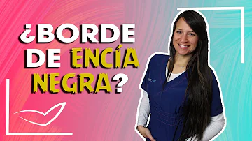 ¿Por qué tengo la encía gris alrededor de la corona?