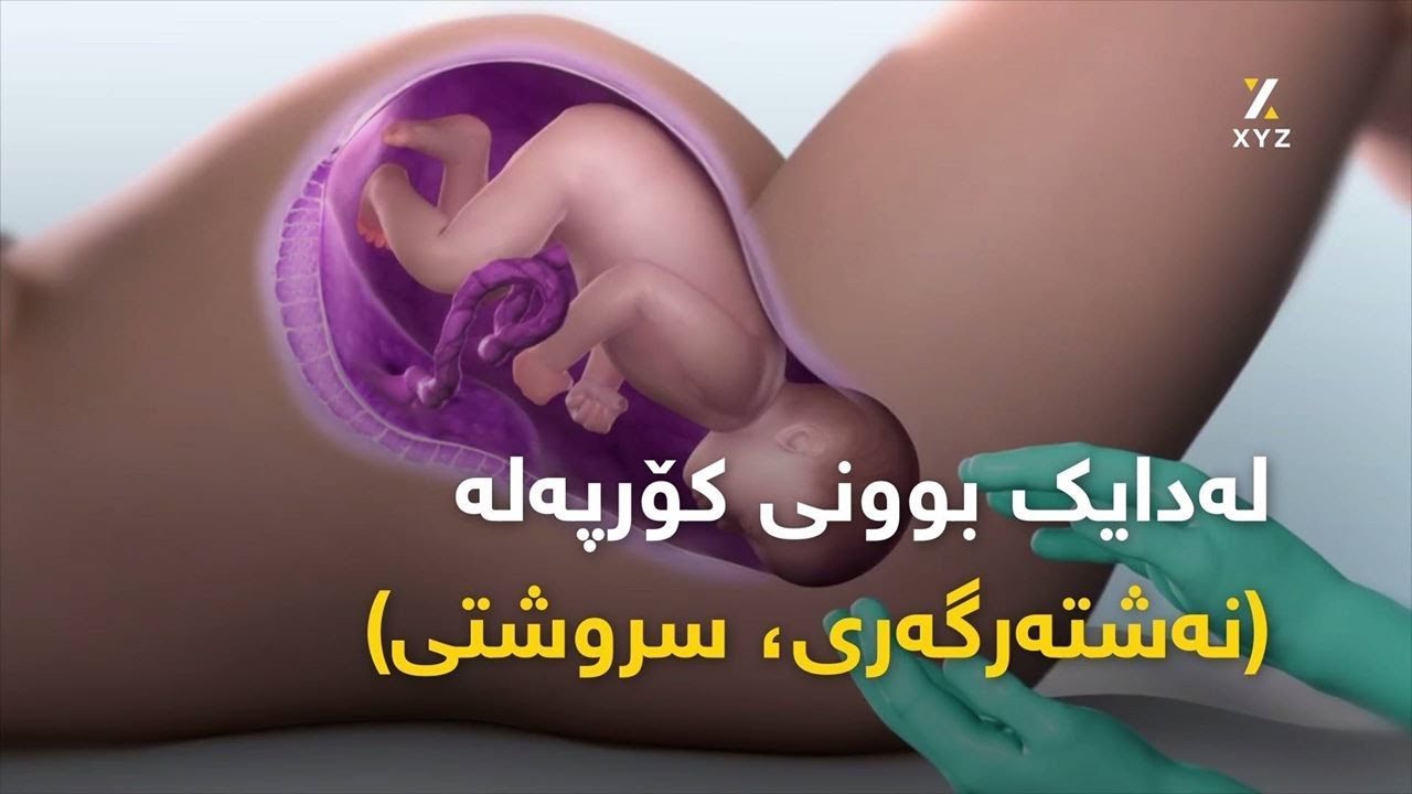 هه‌مووشتك ده‌رباره‌ی له‌دایكبوونی كۆرپه‌له‌