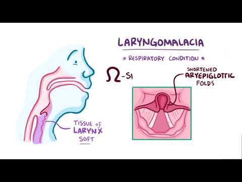 Video: Laryngomalacia: Behandling, Orsaker, Diagnos, Outlook Och Mer