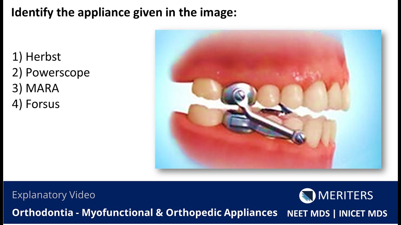 NEET MDS INICET OrthodontiaMyofunctional & Orthopedic Appliances