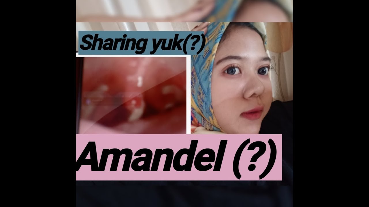 RADANG TENGGOROKAN atau AMANDEL (?) // asaarius 
