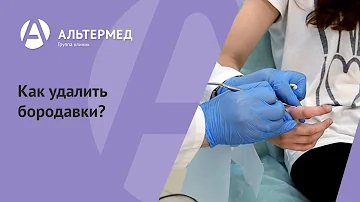 Как удалить бородавки?