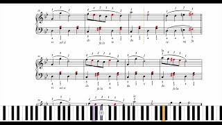 Les contes de la rue Broca (arrangement easy) - Slavin