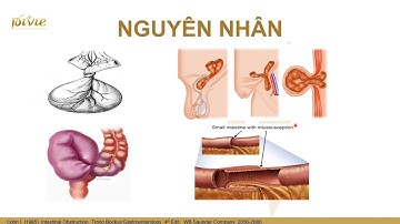 Học thử: Luyện thi BSNT Ngoại khoa ĐH Y Dược HCM 2025 Bài 2: Tắc ruột cơ học